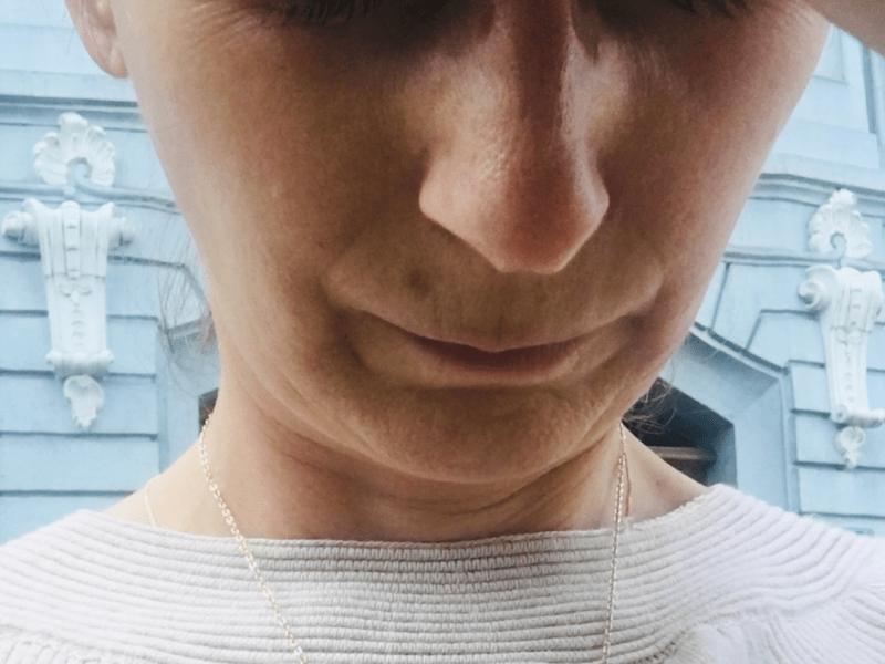 Hektik, mein ärgster Migräne&nbsp;Trigger